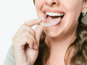 alinhadores invisíveis