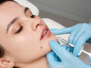 preenchimento labial